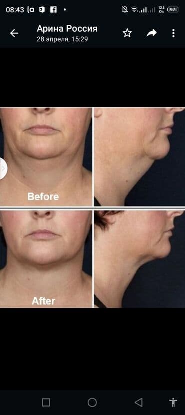 самый лучший эндокринолог рядом просп жибек жолу бишкек: Косметология, Ботокс, Восстановление объема губ, Лифтинг нити, С выездом на дом, Консультация, Гипоаллергенные материалы — 4