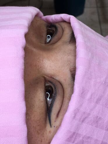 сангапури: Косметология, Маски, Биоревитализация, Ботокс, С выездом на дом, Консультация, Гипоаллергенные материалы — 4