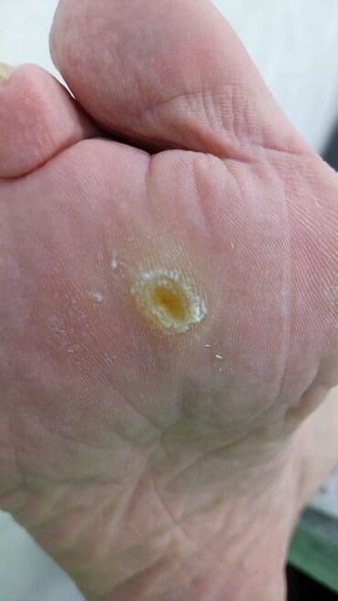 сколько стоит обучение на мастера маникюра: Коррекция вросших ногтей, Маникюр, Педикюр, Услуги подолога, Консультация, Одноразовые расходные материалы — 13