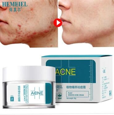 крем для угри: Крем от акне HEMEIEL. Особенности: 1. Специальная восстанавливающая — 2