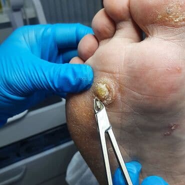 сколько стоит обучение на мастера маникюра: Коррекция вросших ногтей, Маникюр, Педикюр, Услуги подолога, Консультация — 19