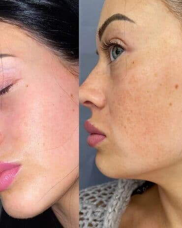 эффективный отбеливающий крем для зоны бикини в аптеке: Expigment Экспигмент Сроки до 2027 Свежая поставка с Турции 🇹🇷 💯% — 8