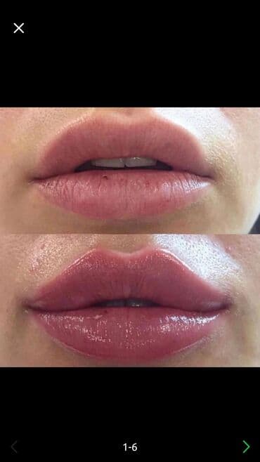 сапоги зимние женские натуральная кожа натуральный мех распродажа: Косметология, Ботокс, Биоревитализация, Ботулинотерапия, Консультация, Гипоаллергенные материалы, Сертифицированный косметолог — 1