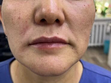 самый лучший эндокринолог рядом просп жибек жолу бишкек: Косметология, Маски, Мезотерапия, Удаление носогубных складок, Гипоаллергенные материалы, Консультация, Сертифицированный косметолог — 10