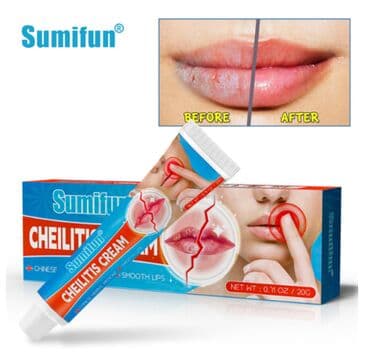 личный кабинет эрсаг кыргызстан: ❄️ Крем Герпес все интересующее на фото только звонки и — 2