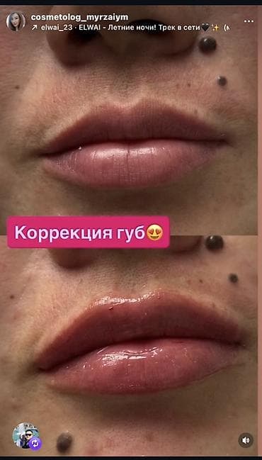 для кожы: Косметология, Чистка кожи, Консультация, Сертифицированный косметолог — 3