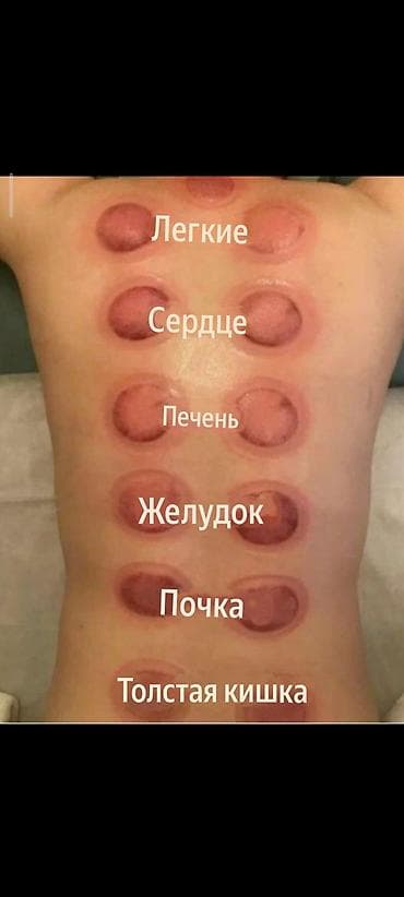 Массаж: Массаж | Сутулость, нарушение осанки — 8