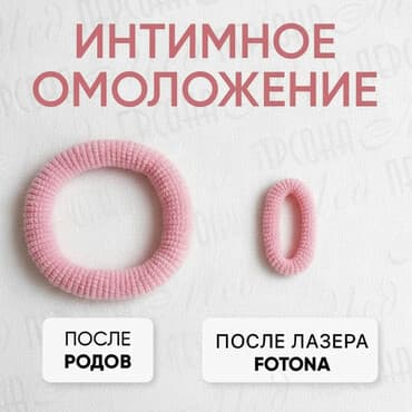 Интимное омоложение HIFU - Лазерная процедура на аппарате Fotona для