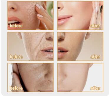 личный кабинет эрсаг кыргызстан: ❄️ сша с аmazon крем антивозрастной увлажняющий и питающий с плаценты — 15