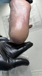 арендовать дом: Выравнивание, Услуги подолога, С выездом на дом, Консультация, Одноразовые расходные материалы — 35