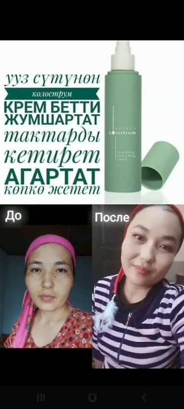 узмакс для роста отзывы: Набор средств ESSENS Colostrum и Sun Care для ухода за кожей Что — 1