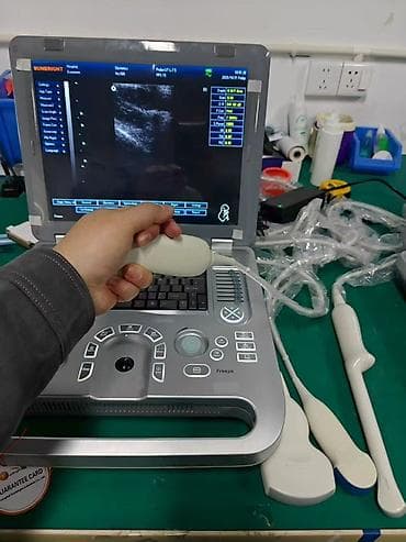 Ингаляторы, небулайзеры: Портативный ультразвуковой аппарат SUNBRIGHT (ноутбучный форм‑фактор) — 5