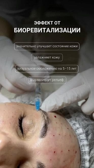 power point: НУЖНЫ МОДЕЛИ ДЛЯ ПОРТФОЛИО.ОПЛАТА ЗА МАТЕРИАЛ. БИОРЕВИТАЛИЗАЦИЯ И — 1