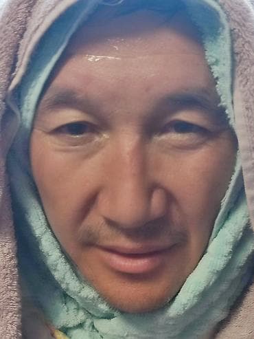 массаж гулчо: Косметология, Чистка кожи, Гипоаллергенные материалы — 10
