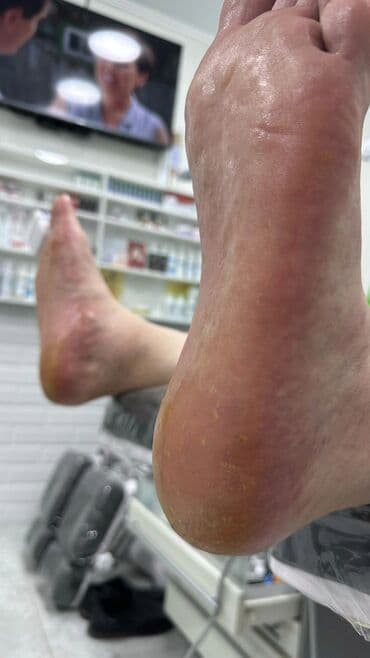 самый лучший эндокринолог рядом просп жибек жолу бишкек: Коррекция вросших ногтей, Маникюр, Педикюр, Услуги подолога, Консультация, Одноразовые расходные материалы — 2