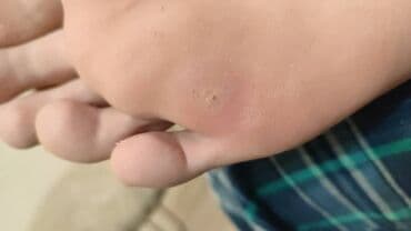 самый лучший эндокринолог рядом просп жибек жолу бишкек: Воосшие ногти, заболевания ногтей, стопы, бородавки, мозоли — 8