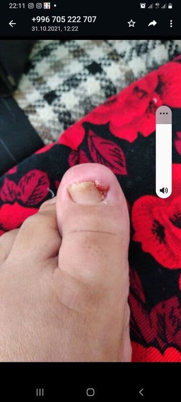 самый лучший эндокринолог рядом просп жибек жолу бишкек: Воосшие ногти, заболевания ногтей, стопы, бородавки, мозоли — 1