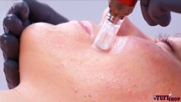 сангапури: Косметология, Брыли, Ботокс, Биоревитализация, Консультация, Гипоаллергенные материалы, Сертифицированный косметолог — 6