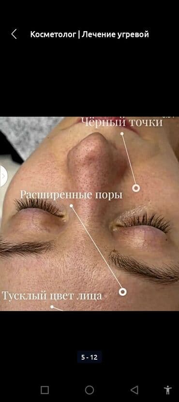 сколько стоит обучение на маникюр: Косметология, Биоревитализация, Ботулинотерапия, Сертифицированный косметолог, Гипоаллергенные материалы, Консультация — 27