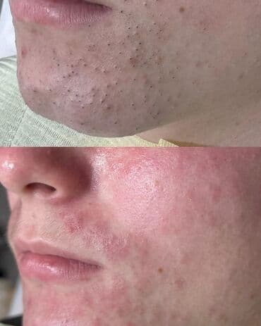 частный роддом бишкек цены: Косметология, Пилинг, Ботулинотерапия, Плазмолифтинг, Консультация, Требуются модели, Сертифицированный косметолог — 5