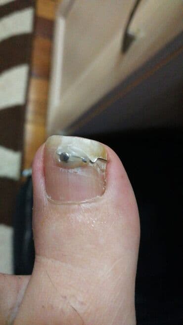 самый лучший эндокринолог рядом просп жибек жолу бишкек: Воосшие ногти, заболевания ногтей, стопы, бородавки, мозоли — 6