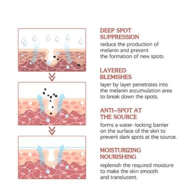 эффективный отбеливающий крем для зоны бикини в аптеке: США Крем отбеливающий для удаления мелазмы осветления кожи удаления — 4