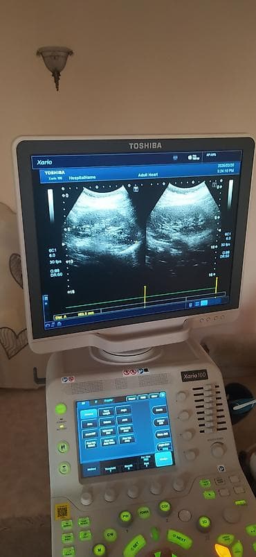 Нитрил кол каптары: Ультразвуковой диагностический аппарат Toshiba Xario 100 - Цветной — 4