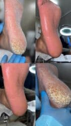 арендовать дом: Выравнивание, Услуги подолога, С выездом на дом, Консультация, Одноразовые расходные материалы — 40