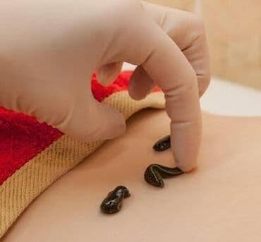 мал базар бишкек: Пиявки медицинские. Сүлүк сатылат. Продаются пиявки. Оптом и в — 1