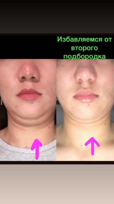 самый лучший эндокринолог рядом просп жибек жолу бишкек: Косметология, Ботокс, Биоревитализация, Ботулинотерапия, Консультация, Гипоаллергенные материалы, Сертифицированный косметолог — 9