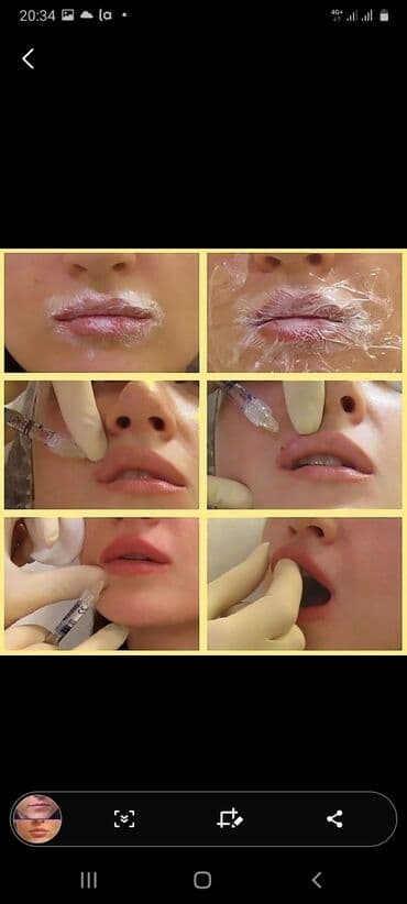 самый лучший эндокринолог рядом просп жибек жолу бишкек: Косметология, Ботокс, Биоревитализация, Ботулинотерапия, Консультация, Гипоаллергенные материалы, Сертифицированный косметолог — 3