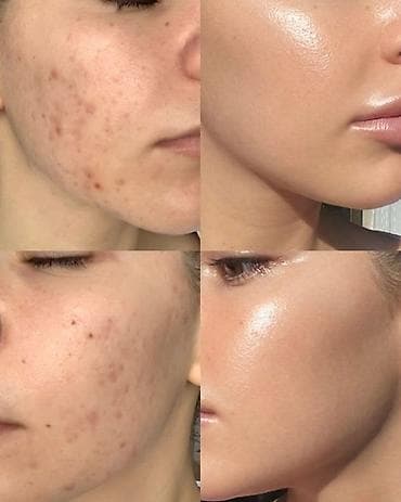 loro pian: Коллаген, Для укрепления иммунитета, Siberian Wellness, Универсальный, Бальзам, Новый — 8