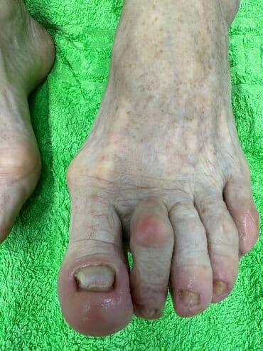 сколько стоит обучение на мастера маникюра: Коррекция вросших ногтей, Маникюр, Педикюр, Услуги подолога, Консультация, Одноразовые расходные материалы — 4