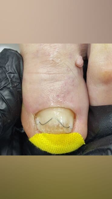 сколько стоит обучение на мастера маникюра: Коррекция вросших ногтей, Маникюр, Педикюр, Услуги подолога, Консультация, Одноразовые расходные материалы — 10