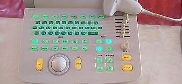 узи скрабер: Продам . Портативный УЗИ аппарат с конвексным датчиком. Прошу 55000 — 2