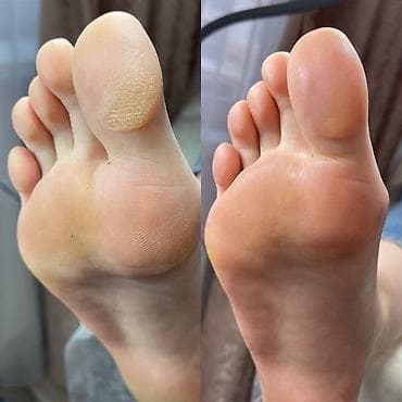 обработка: Выравнивание, Наращивание ногтей, Гель лак, шеллак, Педикюр, Одноразовые расходные материалы, Услуга в 4 руки — 3