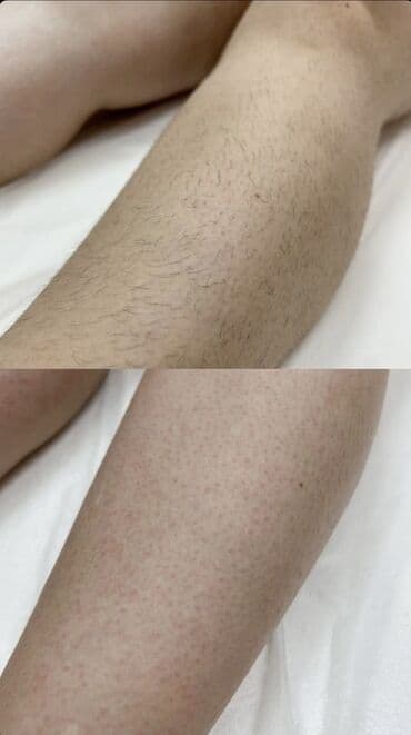 Шугаринг 😍 Гладкая и нежная кожа всегда выглядит роскошно 🔥
