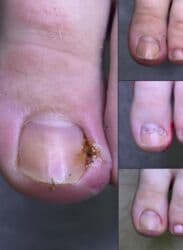 арендовать дом: Выравнивание, Услуги подолога, С выездом на дом, Консультация, Одноразовые расходные материалы — 18