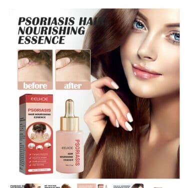 Киреге берилүүчү кийимдер: ❄️ США псориаз головы средство с валмарта питательная эссенция для — 1