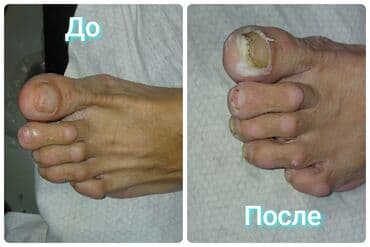 реставрация кухонной мебели бишкек: Выравнивание, Дизайн, Наращивание ногтей, Маникюр, Педикюр, С выездом на дом, Одноразовые расходные материалы, Требуются модели — 20