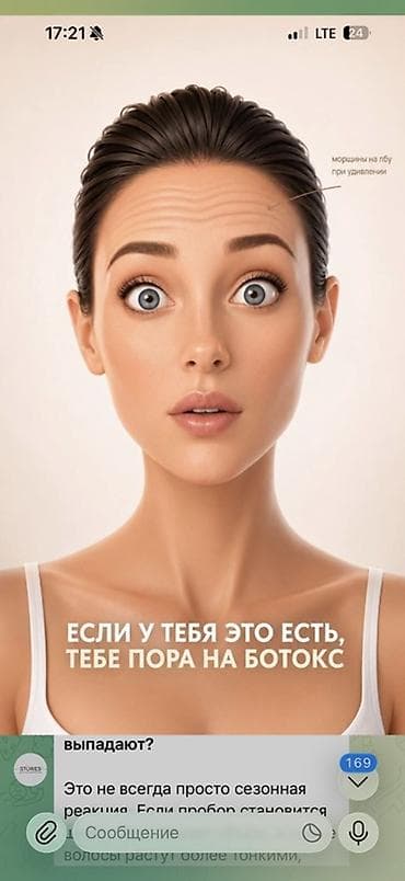 Услуги: Ботокс для лица — инъекции нейромодулятора для расслабления мимических — 2