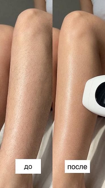 google home: 🏥 Лазерная эпиляция в клинике УмБем 🔥🔥🔥🔥🔥Все тело 3999 📍 Ош/ Ош — 2