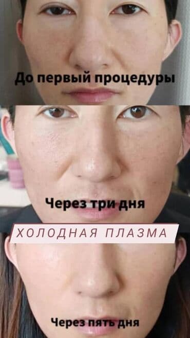 самый лучший эндокринолог рядом просп жибек жолу бишкек: Косметология, Ботокс, Биоревитализация, Ботулинотерапия, Консультация, Гипоаллергенные материалы, Сертифицированный косметолог — 7