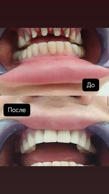 Резюмелер: Стоматолог. 6 жылдан ашык тажрыйба. Орун ижарасы — 3