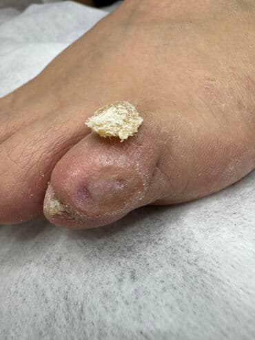 самый лучший эндокринолог рядом просп жибек жолу бишкек: Наращивание ногтей, Укрепление ногтей, Ремонт сломаных ногтей, Маникюр, Педикюр, С выездом на дом, Консультация, Одноразовые расходные материалы — 9