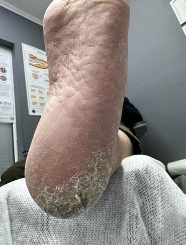 на дом керек: Услуги подолога, С выездом на дом, Консультация, Одноразовые расходные материалы — 6