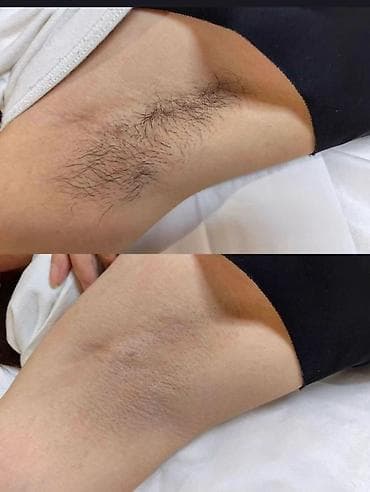 паравое: Акция Ноги руки полностью, глубокое бикини, подмышки. 1300 сом — 4