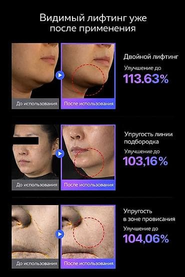 blender bottle: Набор для домашнего ухода Mommy Care: приборы Penta Prime и EMS — 8