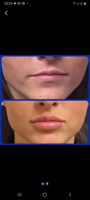 самый лучший эндокринолог рядом просп жибек жолу бишкек: Косметология, Ботокс, Биоревитализация, Ботулинотерапия, Консультация, Гипоаллергенные материалы, Сертифицированный косметолог — 1