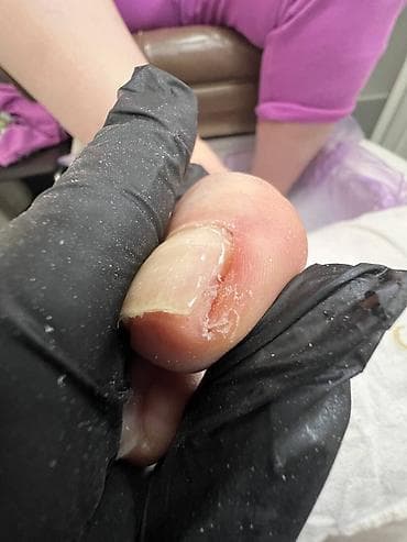 🦶 ПОДОЛОГ — ЭТО НЕ ПРОСТО ПЕДИКЮР. ЭТО ЗДОРОВЬЕ И КОМФОРТ ВАШИХ НОГ ✨ — 1